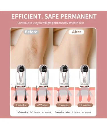 USA Imported Professional IPL Hair Removal Device – 5 Energy Levels, 999,999 Flashes
