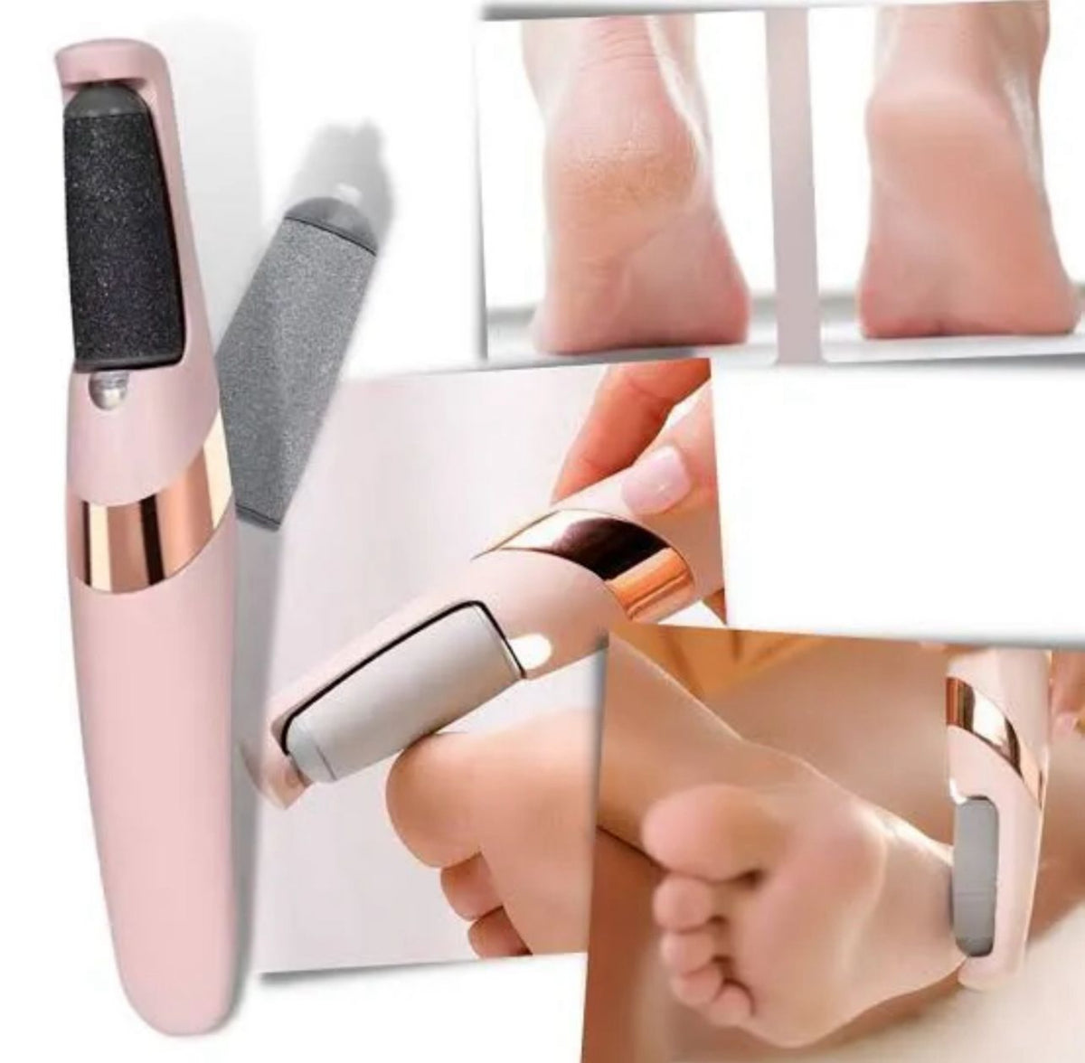 Electric Callus Remover for Feet | Rechargeable Pedicure Tool
